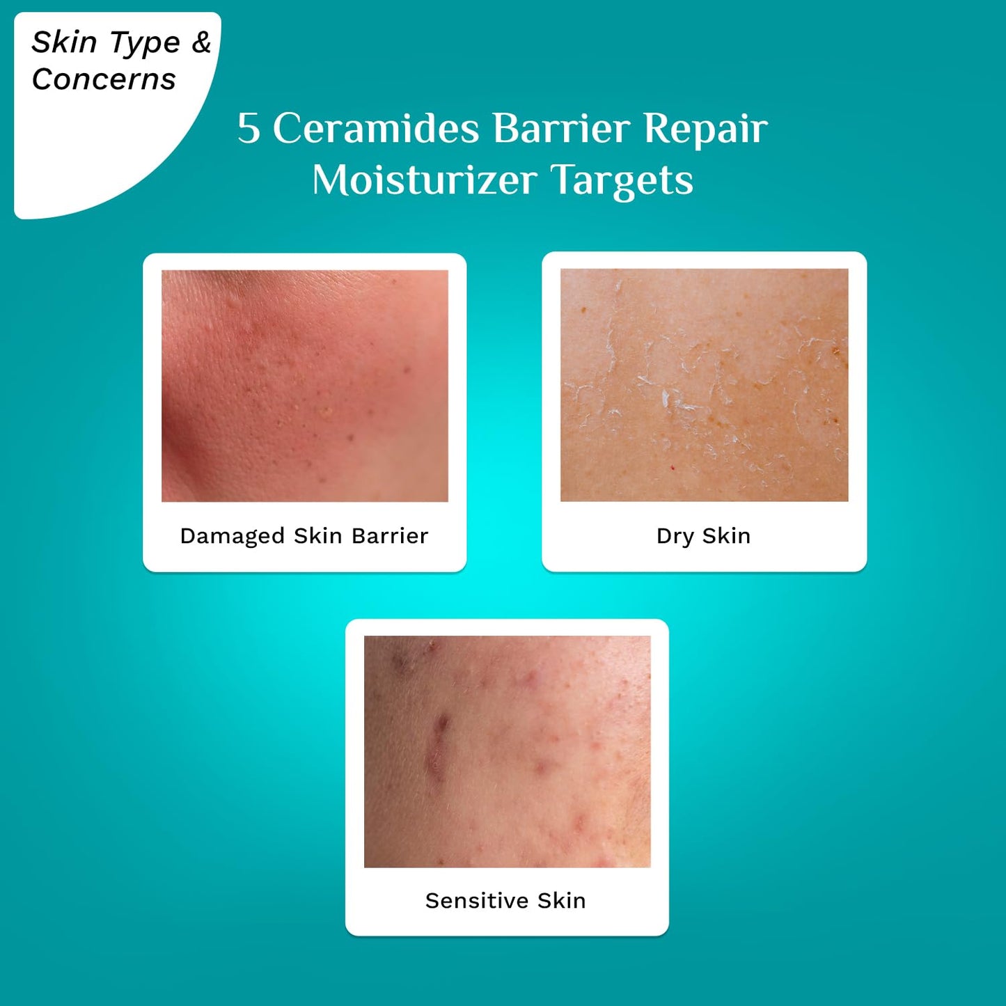 Pilgrim 5 Ceramides Barrier Repair Moisturizer (100 g)