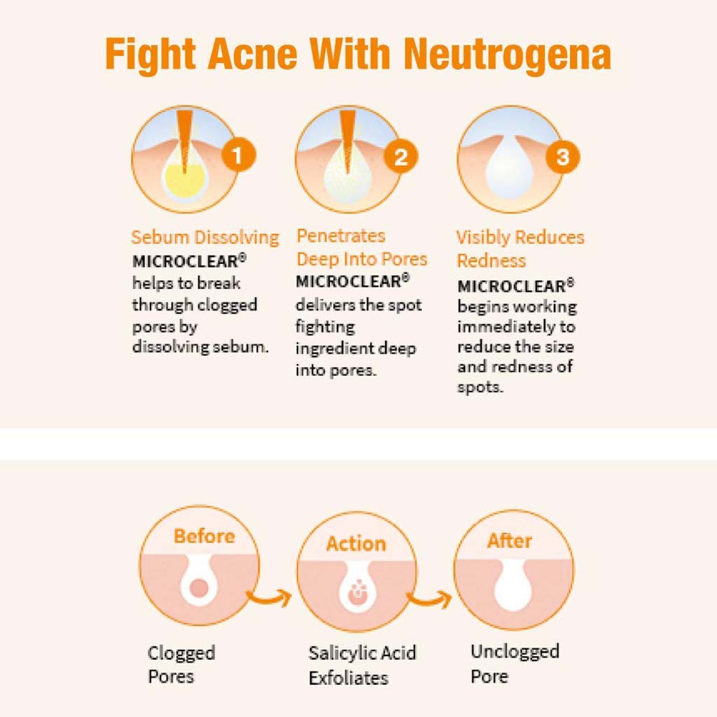 Neutrogena Oil Free Acne Wash (175 ml)